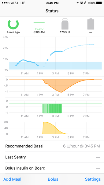 Loop puts the brain on your phone