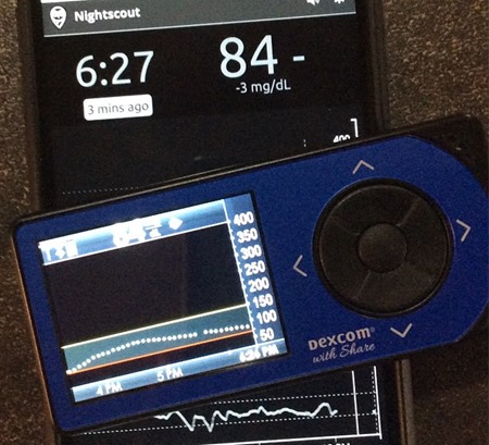 Dexcom Share