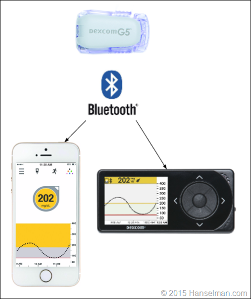 How the Dexcom G5 system works