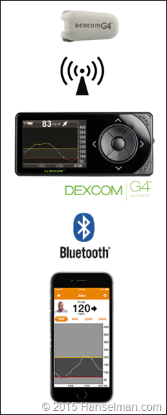 How the Dexcom G4 system works