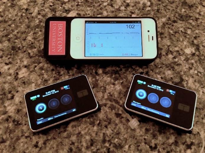 It's two pumps, one with insulin, one with glucagon, and an iPhone controlling them both