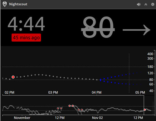 Whoa my Blood Sugar is a CGM in the Cloud!