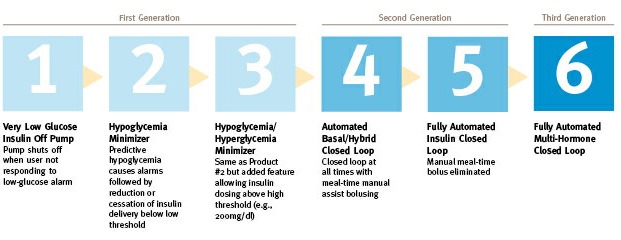 Artificial Pancreas generations