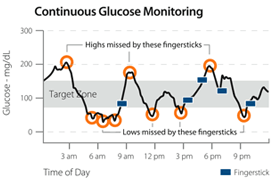 CGM Chart